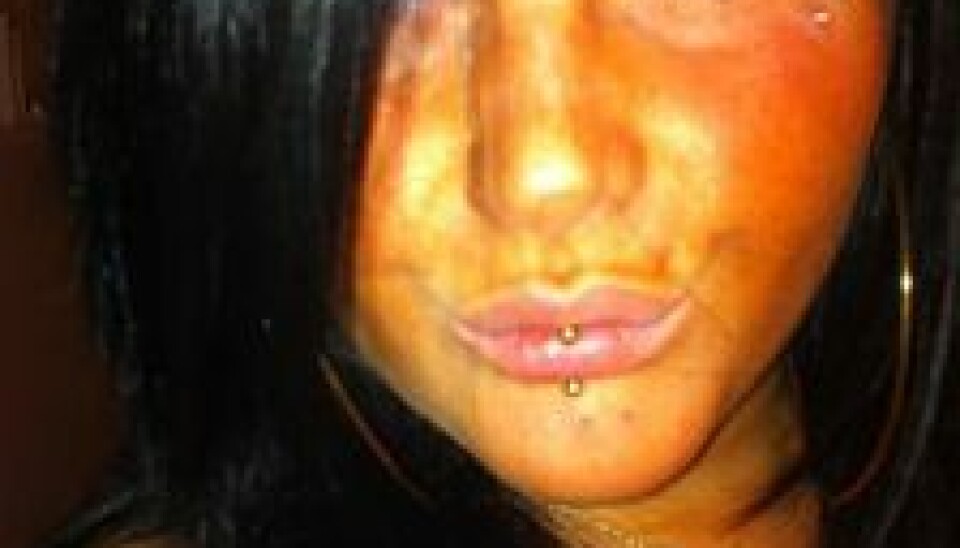 Nanna med nogle af sine piercinger i ansigtet. (Foto: privat)