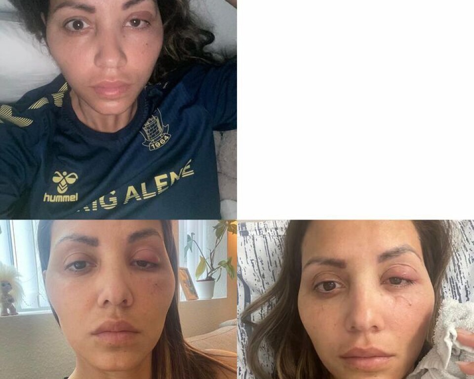 Realitystjerne i chok: Ikke til at kende