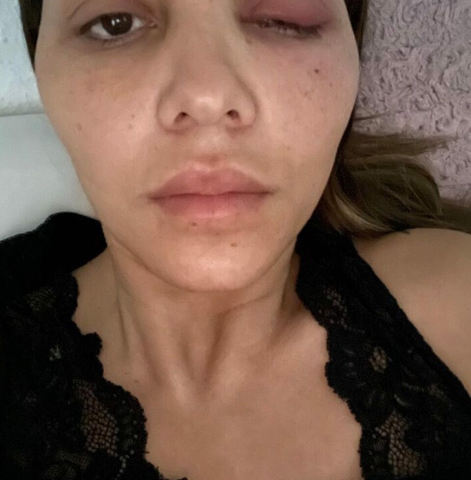 Realitystjerne i chok: Ikke til at kende