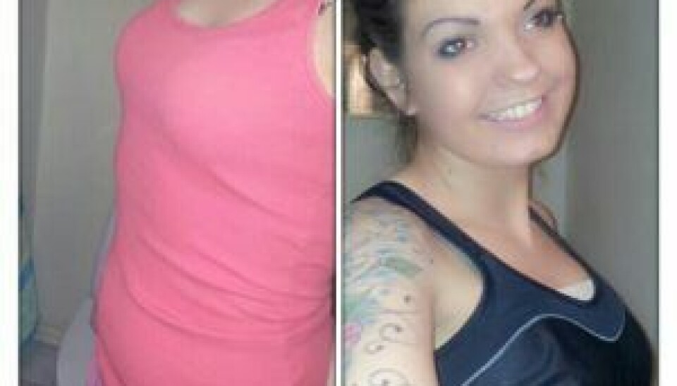 Hannah synes, de ser store ud, men hævelsen skal lige fortage sig. (Foto: Facebook)