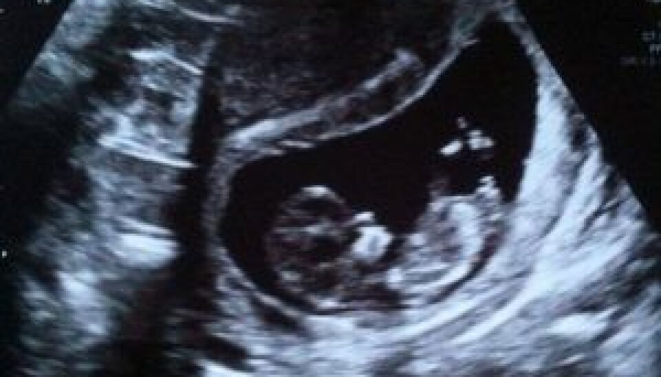 Her er beviset på baby-lykken, der gemmer sig i maven på Line. (Foto: Privat)