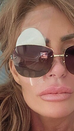 Chok for Anni Fønsby: Har mistet synet