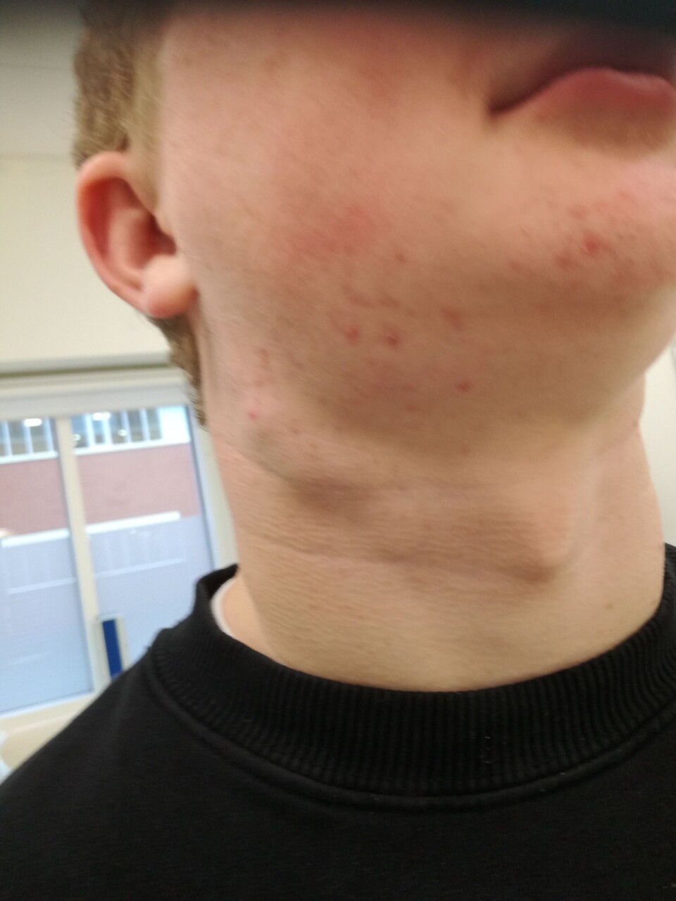 Lasse knuder i halsen.jpg