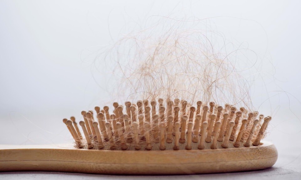 7 grunde til kvinders hårtab