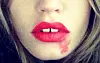 #SmearForSmear