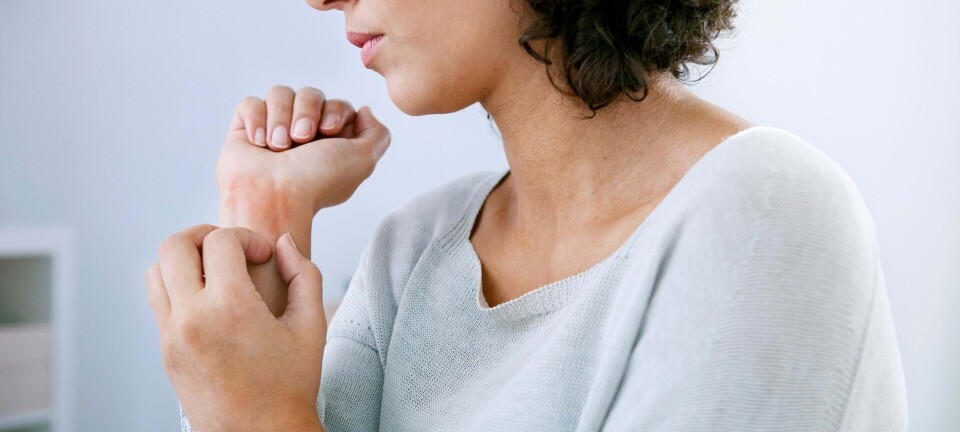 Lider du af nældefeber?