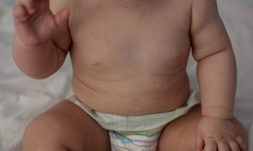 Hvad er varmeknopper hos baby?