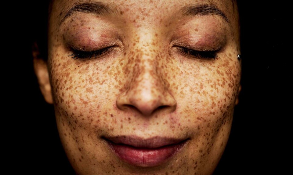 Microneedling, nanoneedling og ansigtsakupunktur behandling