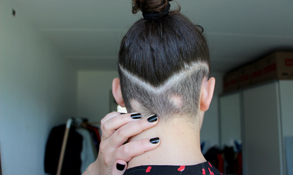 Amanda blev fejlbehandlet for sin hjernerystelse: ”Jeg skulle nok have insisteret, men der var ingen, der tjekkede mig”