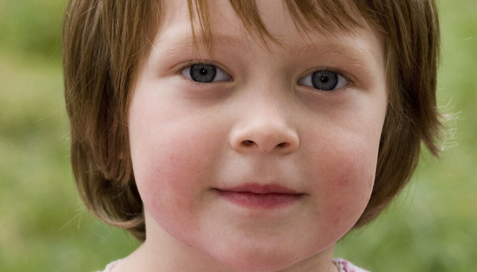 Foto: Thomas Marrot/TV 2