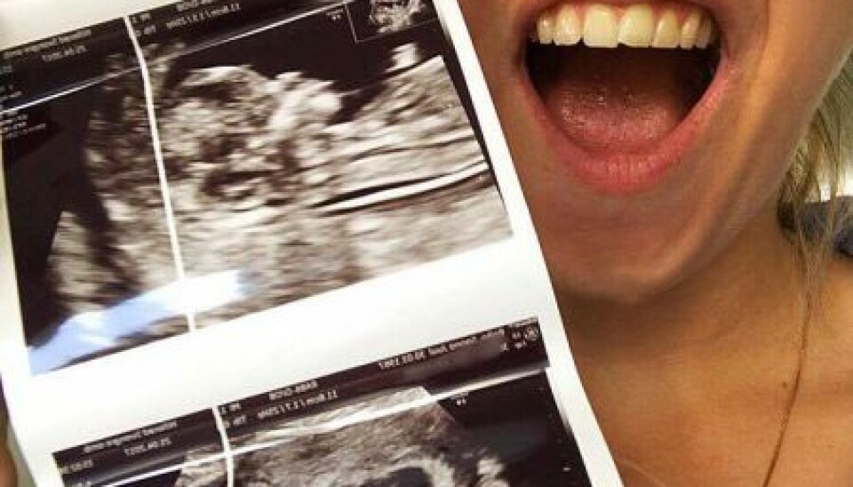 Lykkelig Sanne med scanningsbilledet (Foto: Privat)