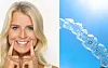 Invisalign hjælper til flottere tænder