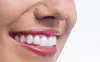 Giv dig selv et smukt smil