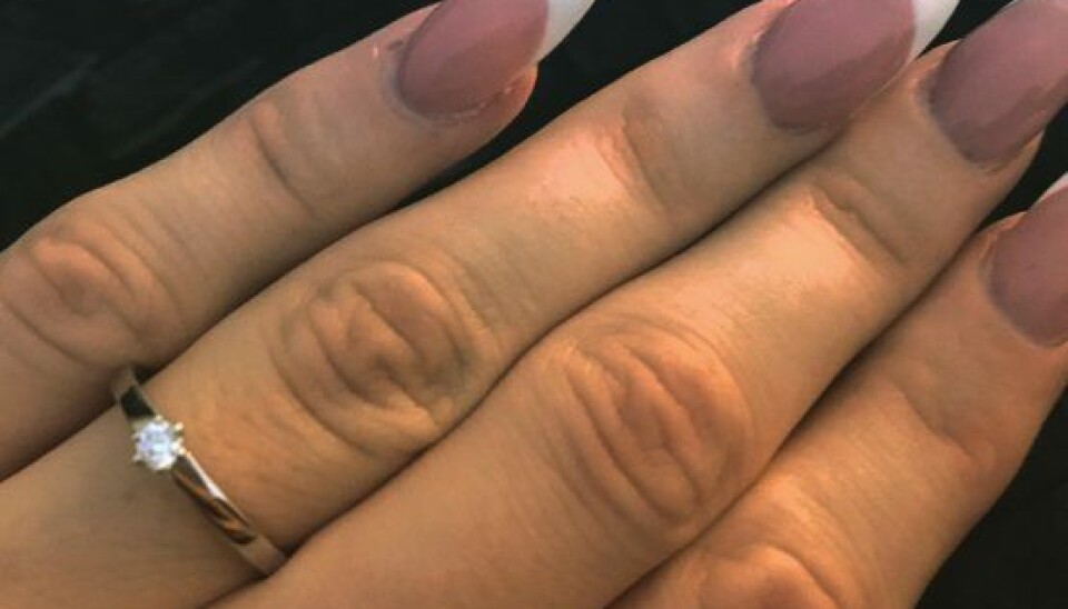 - Den er så smuk. Jeg har aldrig set noget lignende, fortæller Line om den diamantring, kæresten havde klar, da han gik på knæ. (Foto: Privat)