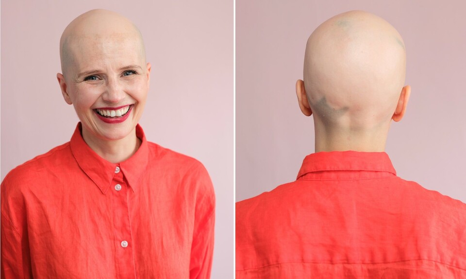 Alopecia_iris3.jpg