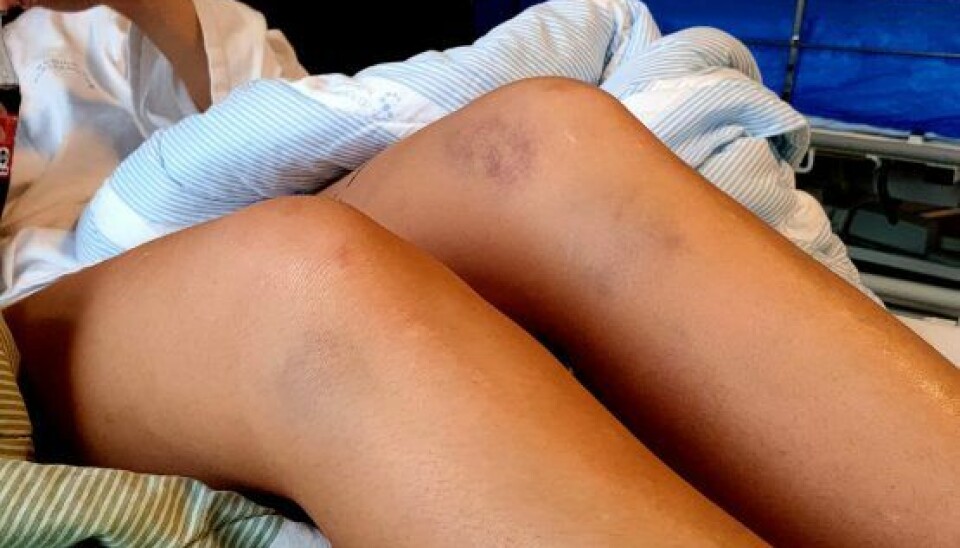 Sabrina slap billigt fra det voldsomme uheld. (Foto: Privat)