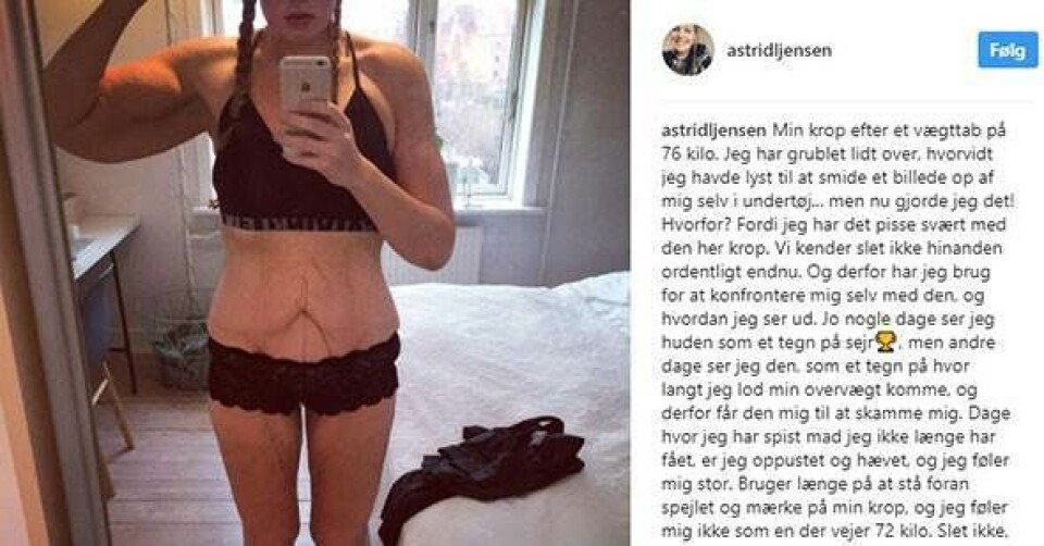 Astrid tabte sig 86 kilo, men fik det sværere med sin krop under tøjet