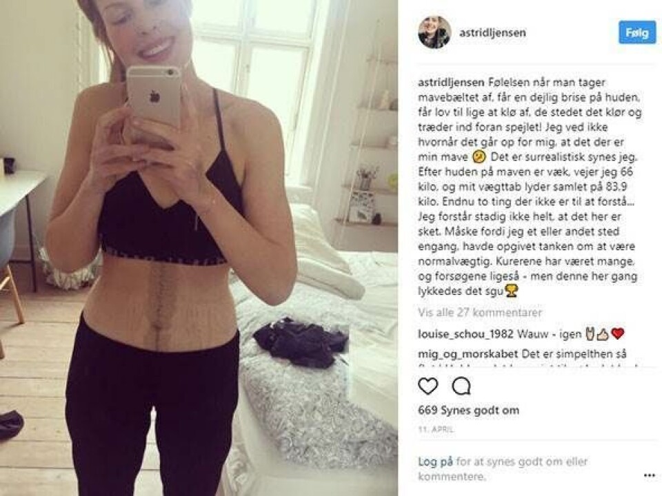 Astrid tabte sig 86 kilo, men fik det sværere med sin krop under tøjet