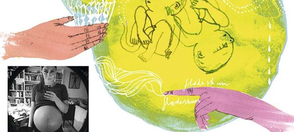 Gravid med tvillinger: Dobbelt op på fedme, flødeskum og fødsel