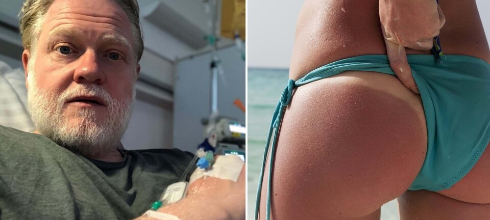 Skuespiller blev skræmt over ny ”sol-trend” blandt unge: Nu deles hans vigtige budskab