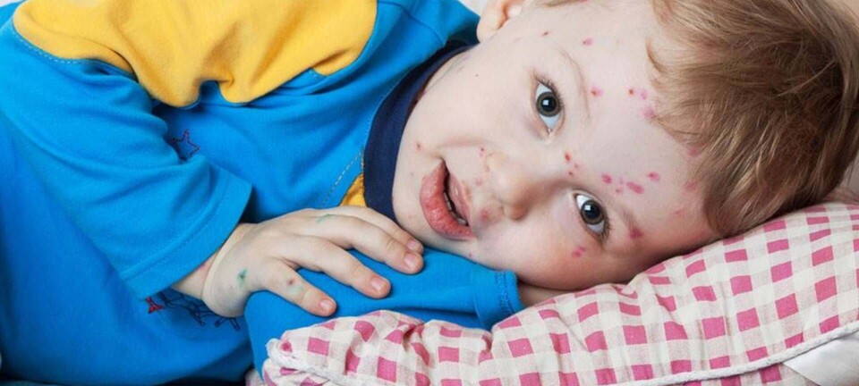 Hjemme med barn syg? Her er 6 ideer til, hvad I kan lave