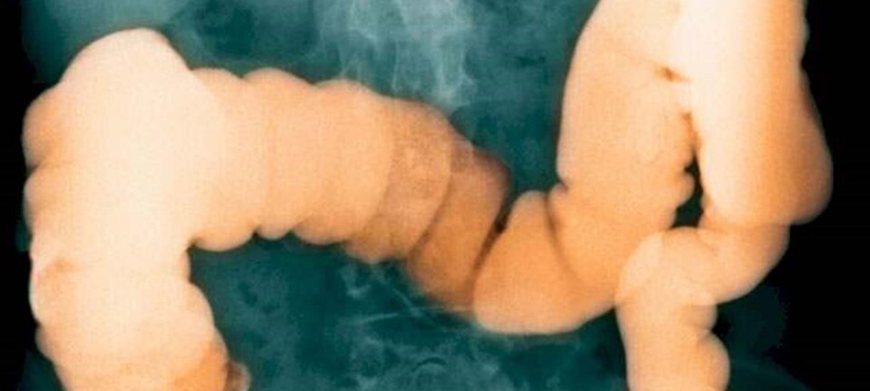 Her er den mest undervurderede faktor for din sundhed