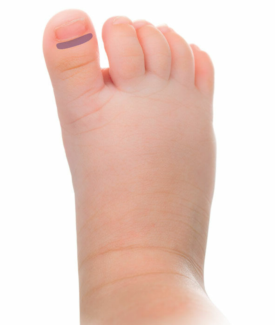 Zoneterapi til børn: Søvn og gode putteritualer