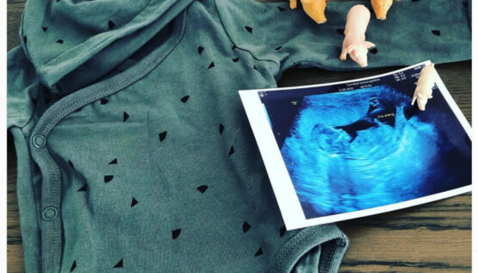 Martin Rathkjen fra 'Landmand søger kærlighed' skal være far for første gang til november med en kæreste, han fandt på Tinder. Hun har i forvejen en søn på to år.Fornylig var parret til scanning og det viste sig, at en søn er på vej.(Foto: privat)