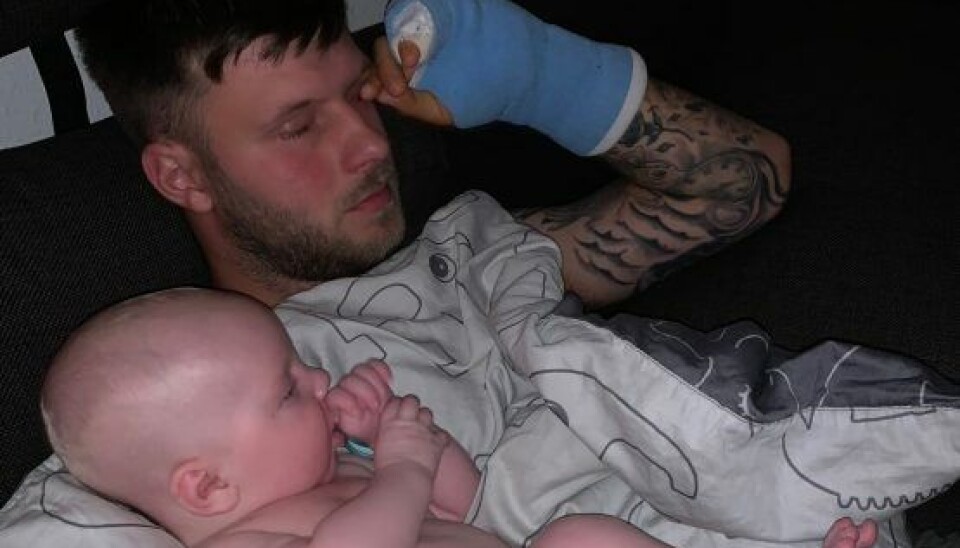 Pludselig havde Louies far Daniel en blå gips om hånden i 'Årgang 20' (Foto: Privat)