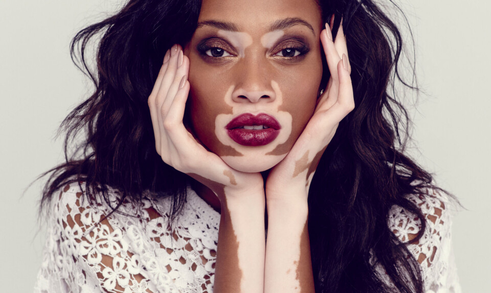 Winnie Harlow