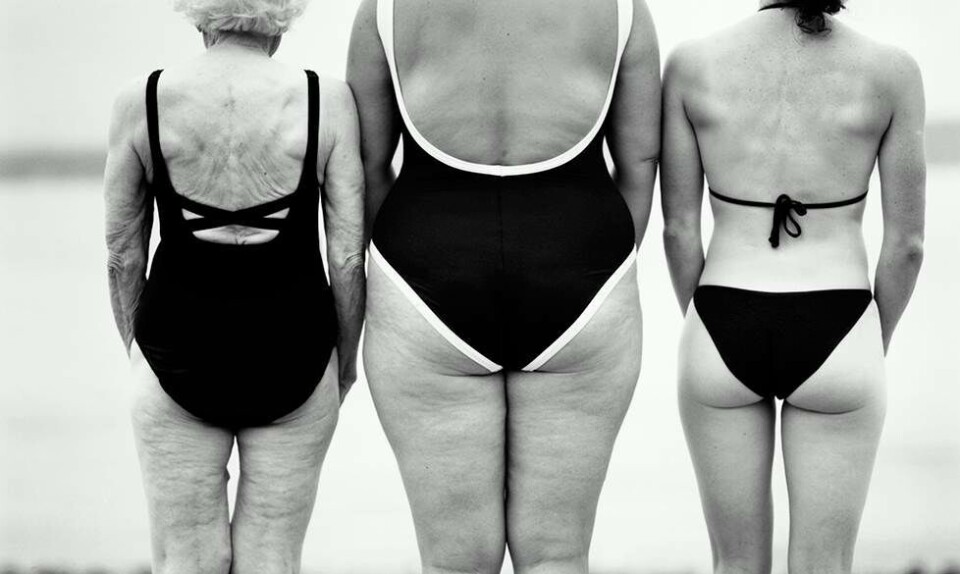 Cellulite