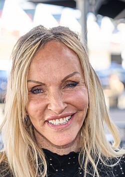 Linse: Derfor er jeg flad