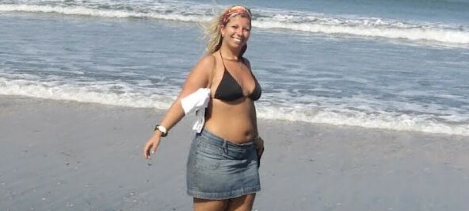 Lipødem-ekspert er ikke i tvivl: Vi skal have større fokus på kvindesygdomme