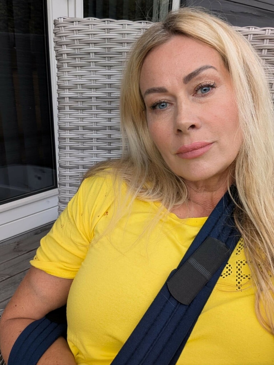 Anamariias blodige styrt: Røg på akutmodtagelsen