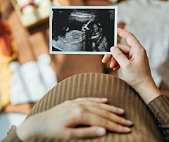 Gravid kvinde holder ultralydsbillede over sin mave omgivet af babyudstyr på gulvet