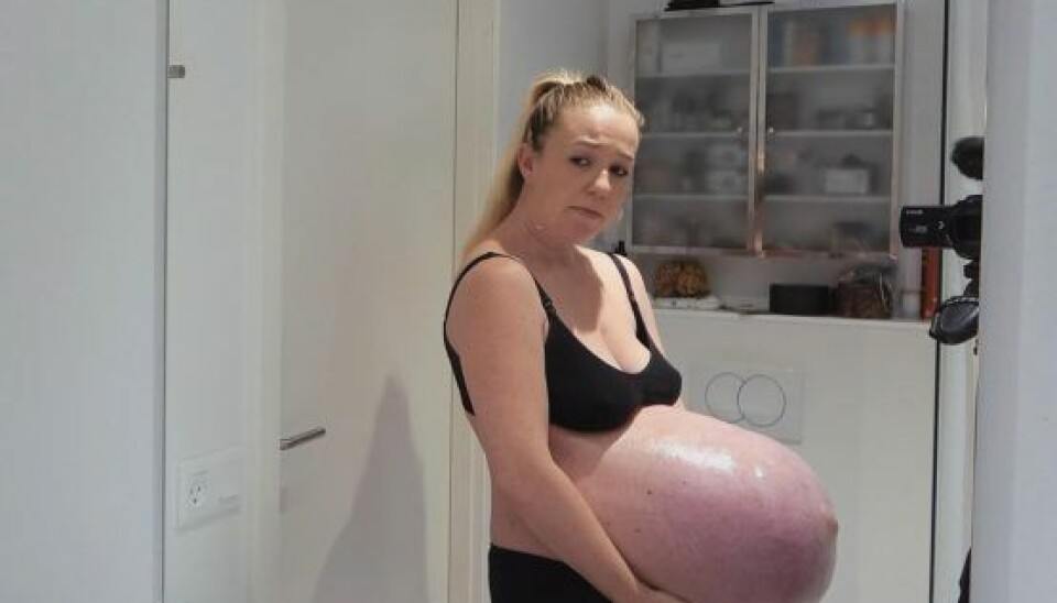 Tillykke, I skal have trillinger (Foto: Michella Morsi/DR)