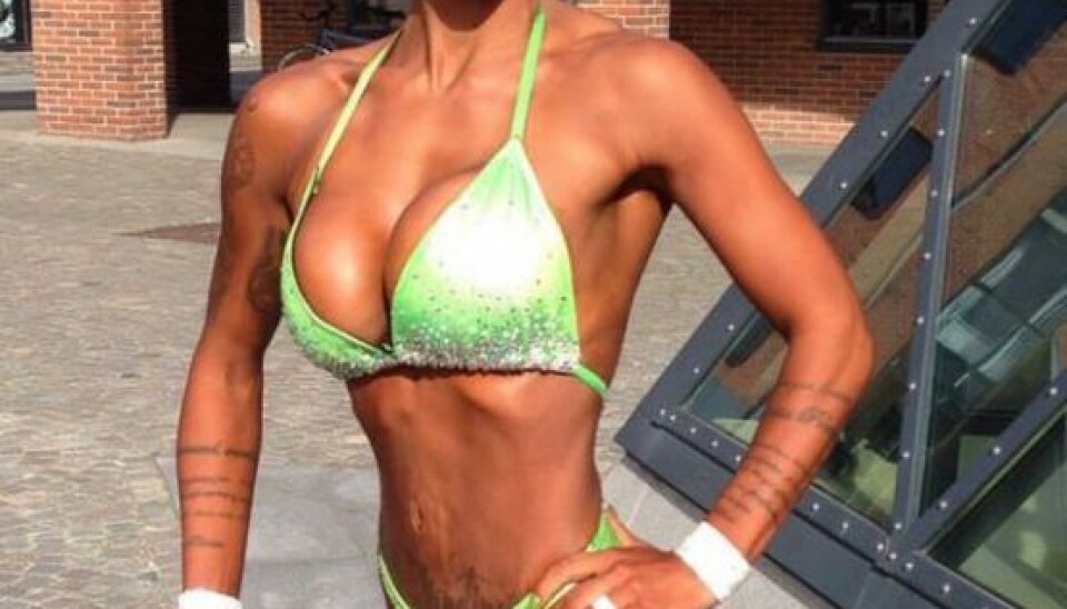Mormoren kørte Mie til Kolding sygehus. Her viste det sig, at Mie Fitness havde stafylokokker i hele maven. De måtte derfor åbne hende igen og lægge en form for svamp ind, som kunne rense hende. Mie giver dog ikke den thailandske klinik skylden.
– Det kunne lige så godt være min egen skyld. Jeg fulgte ikke anbefalingerne, og jeg lå ikke stille efter operationen, fortæller hun.
LÆS OGSÅ: Nicolai Schwartz afslører baby-projekt i 2023
Et par uger efter sygehusbesøget var Mie Fitness rask igen, og i dag fortryder Mie ikke operatonerne og sin tur til Thailand.
- Jeg er mega tilfreds med resultatet, og jeg ville gøre det igen.